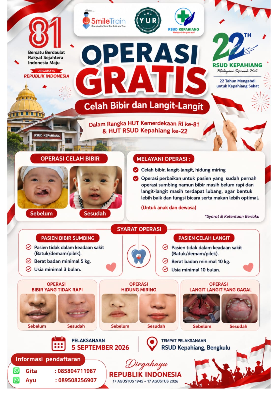 Memperingati HUT RSUD Kabupaten Kepahiang Ke -22 Sekaligus Memperingati HUT RI Ke-81,RSUD Kabupaten Kepahiang Gelar Bhakti Sosial Operasi Bibir Sumbing